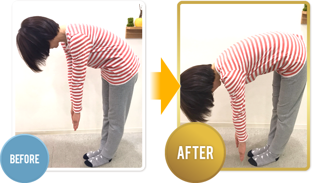 腰痛女性の施術Before After